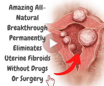 Fibroids Miracle