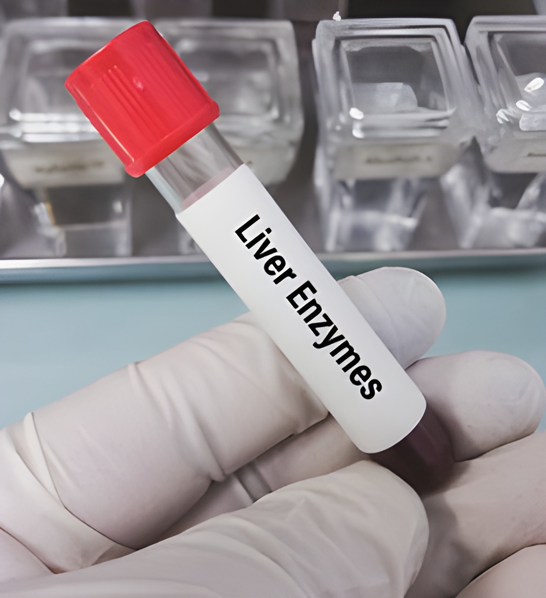 Elevated Liver Enzymes Calculator: What Your ALT, AST, and ALP Levels ...